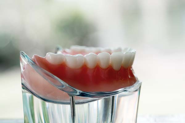 Common Questions About Denture Repair