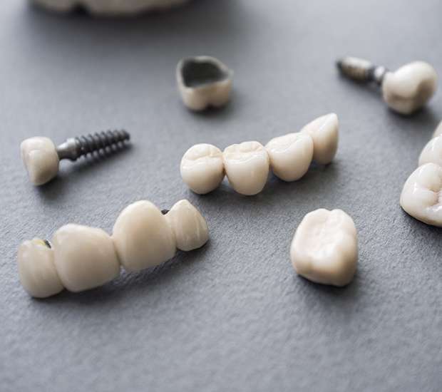 Linden The Difference Between Dental Implants and Mini Dental Implants